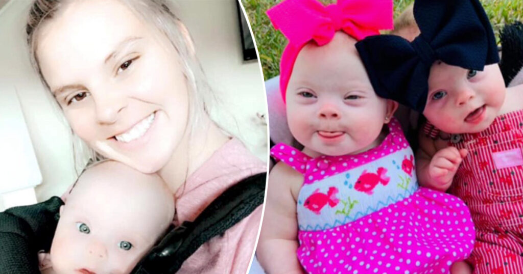 Florida woman gives birth to rare set of identical twins with Down syndrome