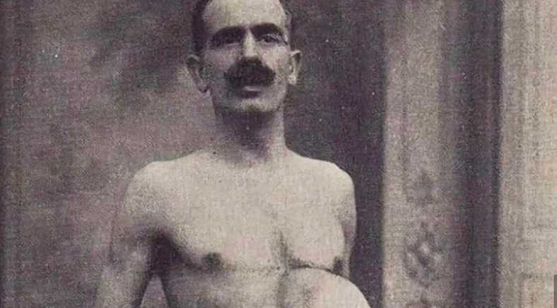 Jean Libbera: The “Double-Bodied Man” Who Lived a Remarkable Life Despite His Parasitic Twin…