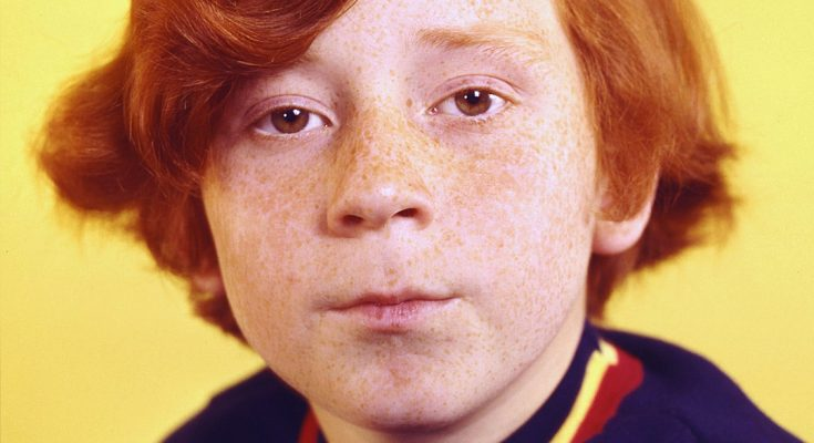 This Child Star Changed Careers After Reaching Fame & Had to Get Brain Surgery After Health Scare – His Story